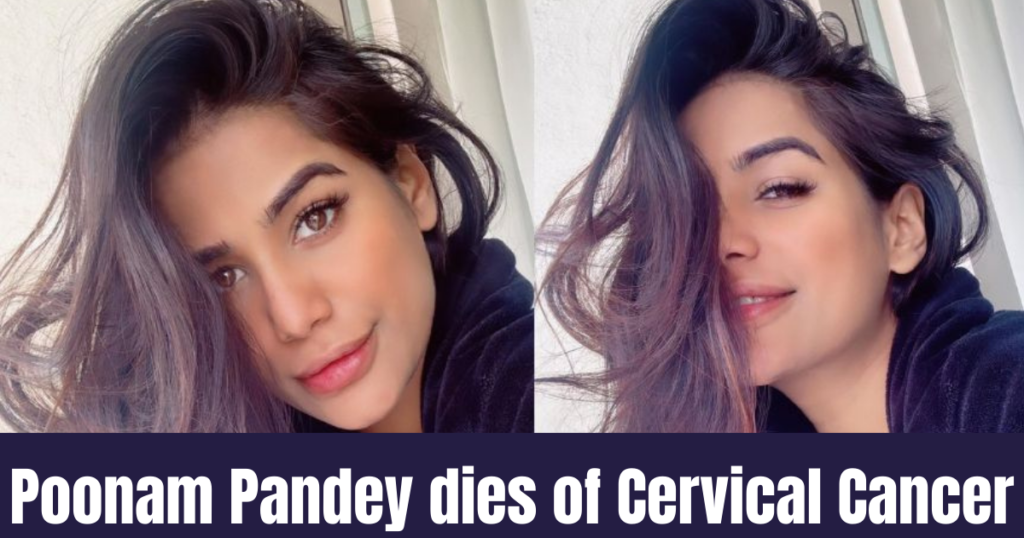 Poonam Pandey has Passed Away Due to Cervical Cancer at 32